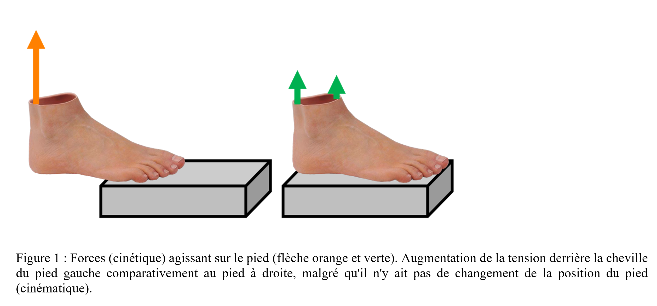 pieds plats course à pied